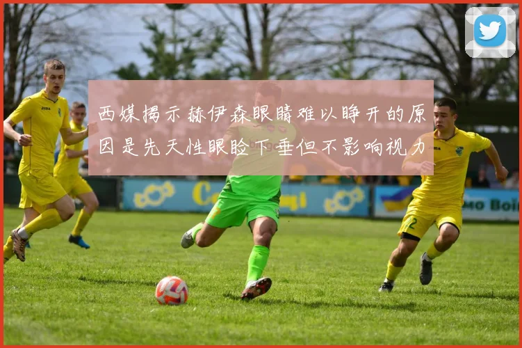 西媒揭示赫伊森眼睛难以睁开的原因是先天性眼睑下垂但不影响视力